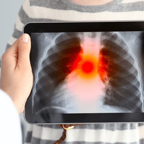 Pulmonology