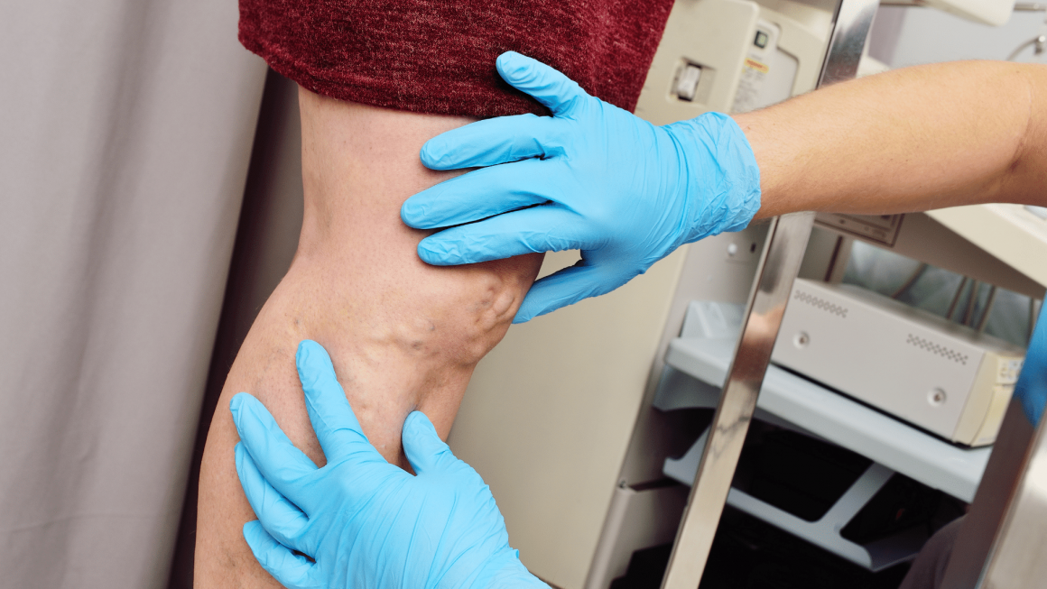 Vascular and Endovascular Surgery