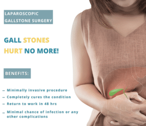 Gallstone surgery in delhi