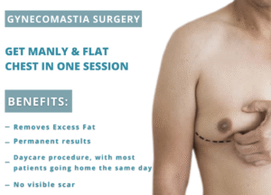 Gynecomastia Surgery in Delhi