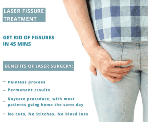 Anal Fissure Treatment in Delhi