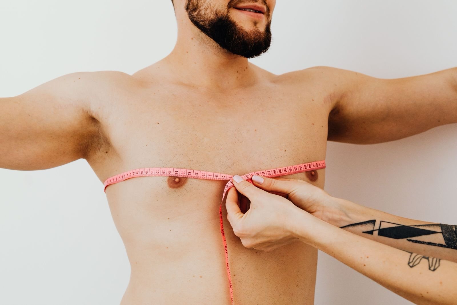 Gynecomastia (male chest reduction) surgery at Sama Hospital, South Delhi