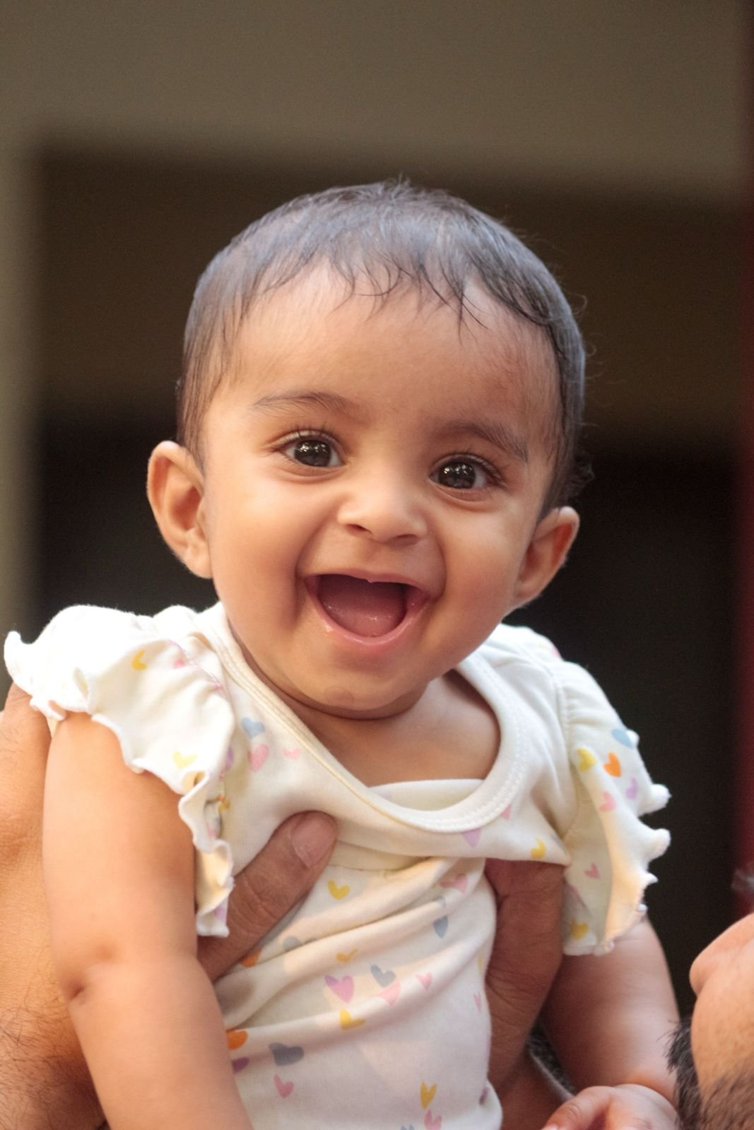 Cleft lip and palate surgery at Sama Hospital, South Delhi