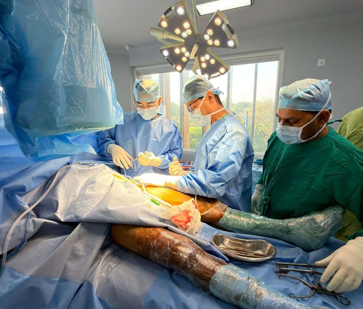 Surgical team performing minimally invasive direct anterior hip replacement at Sama Hospital, South Delhi